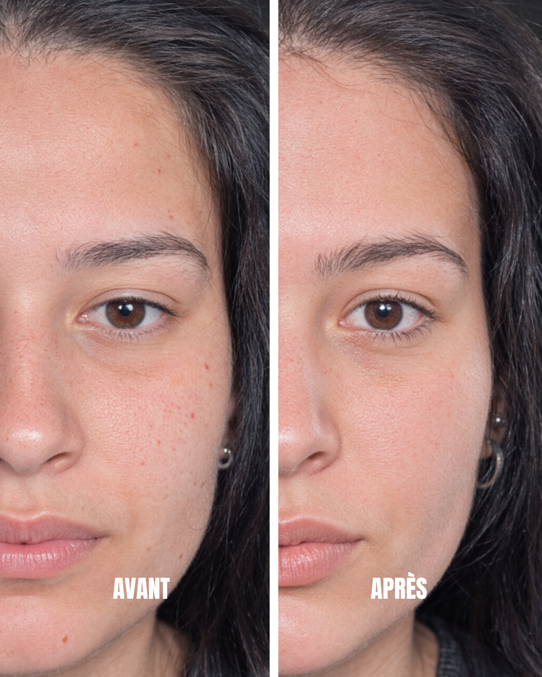 BROSSE LYMPHATIQUE VISAGE